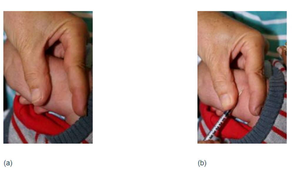 Figure 2.3: The infant BCG vaccination site, and how to support the infant’s arm and hold the syringe