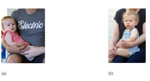 Figure 2.5: Cuddle positions for vastus lateralis or deltoid injections in children