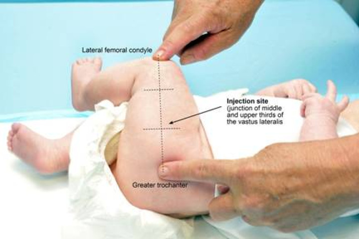 Figure 2.2: The infant lateral thigh injection site